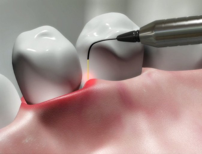 Thousand Oaks Laser Dentistry
