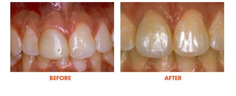 Thousand Oaks Smile Gallery