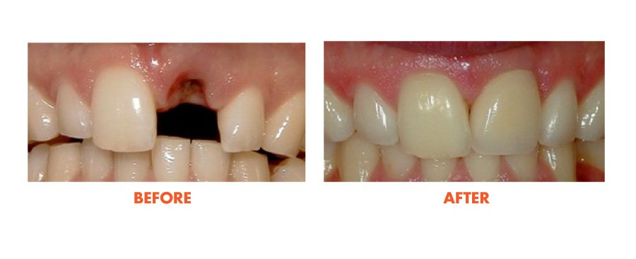 Thousand Oaks Smile Gallery