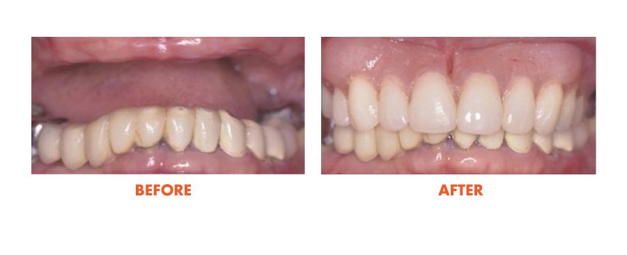 Thousand Oaks Smile Gallery