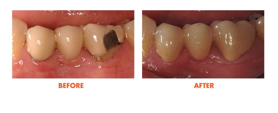 Thousand Oaks Smile Gallery