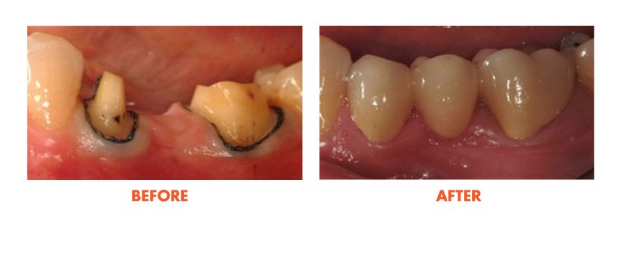Thousand Oaks Smile Gallery