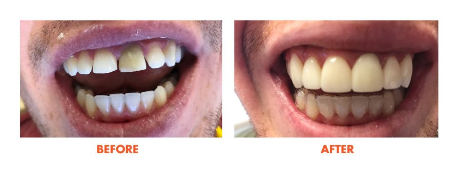 Thousand Oaks Smile Gallery