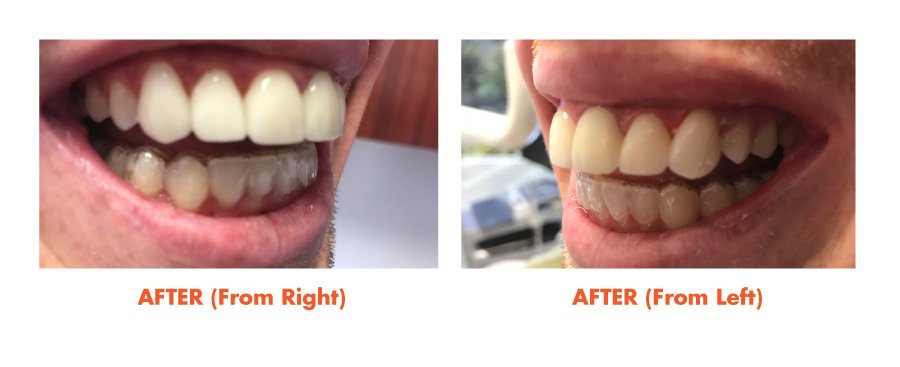 Thousand Oaks Smile Gallery